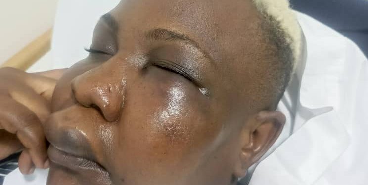 VIDEO! Full Figure Attacked by Two Goons, Hospitalised