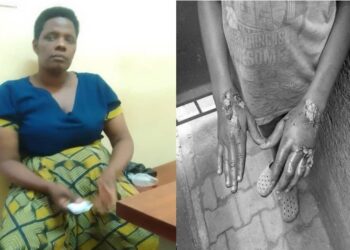 Woman Arrested After Burning Nephew’s Hands Over UGX 100,000