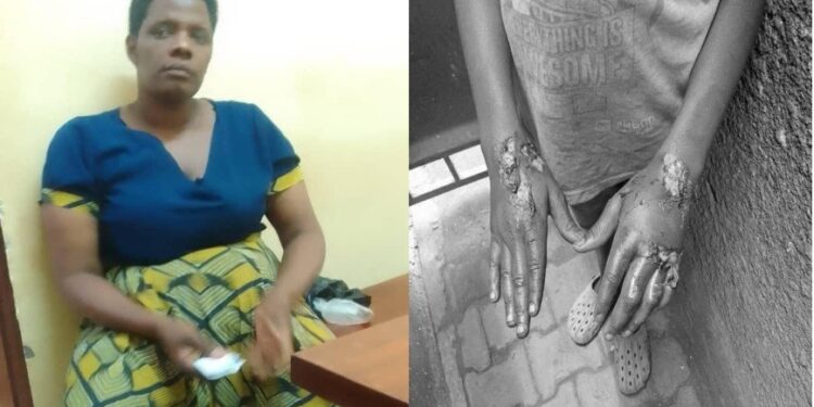 Woman Arrested After Burning Nephew’s Hands Over UGX 100,000
