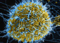 Breaking! Ebola Confirmed In Bundibugyo District