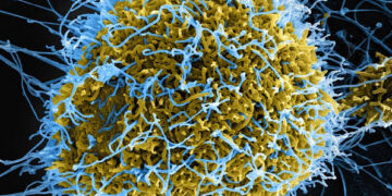 Breaking! Ebola Outbreak Confirmed In Bundibugyo District