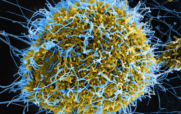 Breaking! Ebola Outbreak Confirmed In Bundibugyo District