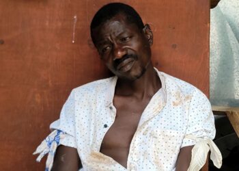 Police Shoot, Injure Man Claiming To Be ‘God’ in Busia Police Panga Attack