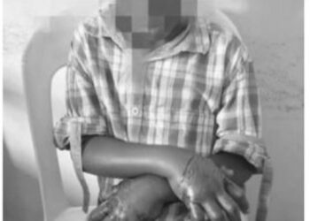Three Family Members Arrested Over Alleged Torture of 10 Year Old Boy