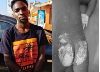 Father Arrested Over Allegedly Torturing his Two Year Old Son in Entebbe