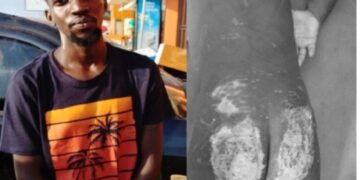 Father Arrested Over Allegedly Torturing his Two Year Old Son in Entebbe